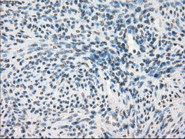 m05737 anti gbp2 mouse monoclonal antibody clone id oti5c8 ihc testing 6