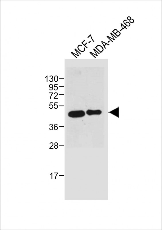 All lanes : Anti-SULT2B1 at 1:2000 dilutionLane 1: MCF-7 whole cell lysateLane 2: MDA-MB-468 whole cell lysateLysates/proteins at 20 µg per lane