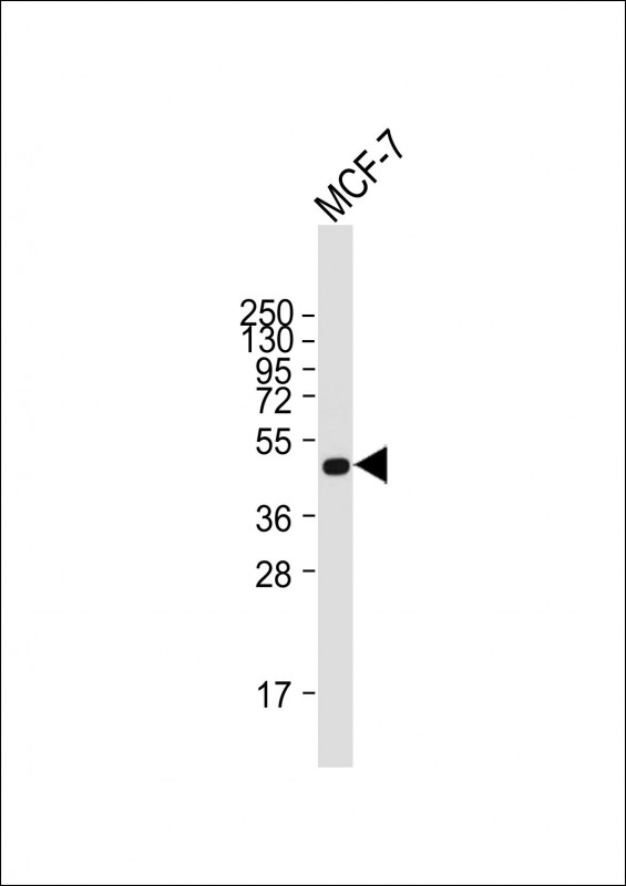 Anti-SULT2B1 at 1:8000 dilution + MCF-7 whole cell lysateLysates/proteins at 20 µg per lane