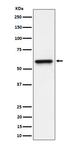 Western blot analysis of RGS6 expression in HeLa cell lysate