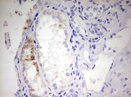 m05757 anti ehhadh mouse monoclonal antibody clone id oti2c4 ihc testing 2