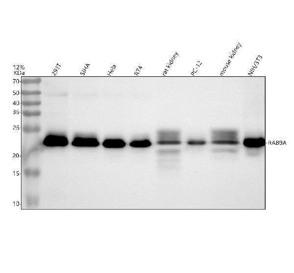 Western blot analysis of RAB9A using anti-RAB9A antibody (M05768)