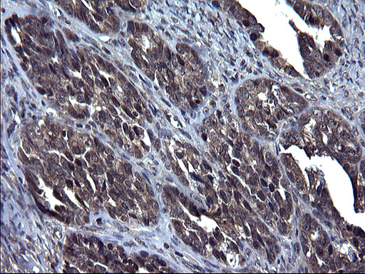 m05772 1 anti txndc5 mouse monoclonal antibody clone id oti2e6 ihc testing 2