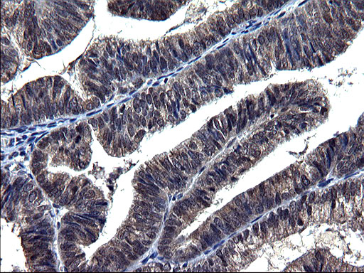 m05772 1 anti txndc5 mouse monoclonal antibody clone id oti2e6 ihc testing 4