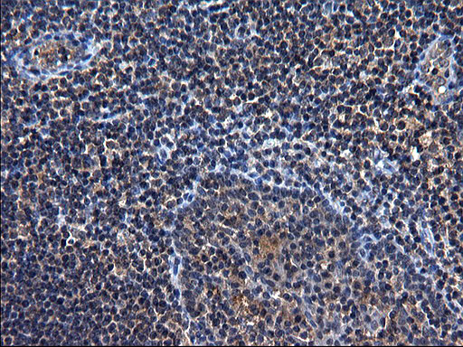 m05772 1 anti txndc5 mouse monoclonal antibody clone id oti2e6 ihc testing 5