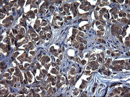 m05772 1 anti txndc5 mouse monoclonal antibody clone id oti2e6 ihc testing 6