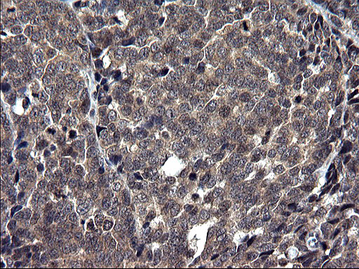 m05772 1 anti txndc5 mouse monoclonal antibody clone id oti2e6 ihc testing 7