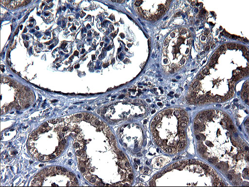 m05772 1 anti txndc5 mouse monoclonal antibody clone id oti2e6 ihc testing 8