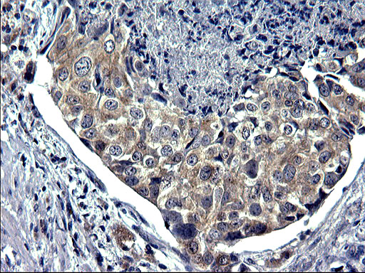 m05772 2 anti txndc5 mouse monoclonal antibody clone id oti1c3 ihc testing 4