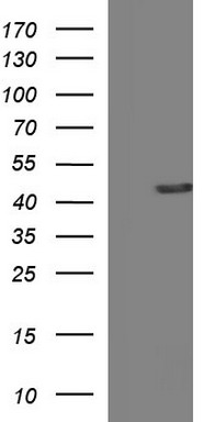 HEK293T cells were transfected with the pCMV6-ENTRY control (Left lane) or pCMV6-ENTRY TXNDC5 (Right lane) cDNA for 48 hrs and lysed