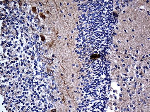 m05775 anti mcf2 mouse monoclonal antibody clone id oti2c12 ihc testing 2