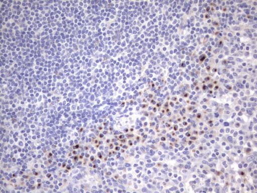 Immunohistochemical staining of paraffin-embedded Human tonsil within the normal limits using anti-ITGB1BP1 mouse monoclonal antibody