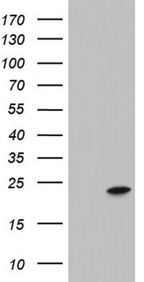 HEK293T cells were transfected with the pCMV6-ENTRY control (Left lane) or pCMV6-ENTRY ITGB1BP1 (Right lane) cDNA for 48 hrs and lysed