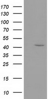 HEK293T cells were transfected with the pCMV6-ENTRY control (Left lane) or pCMV6-ENTRY GMDS (Right lane) cDNA for 48 hrs and lysed