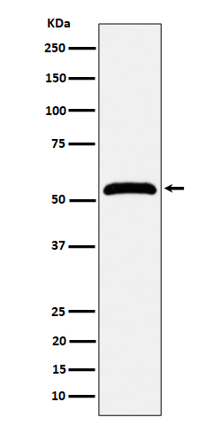 Western blot analysis of MPP1 expression in Jurkat cell lysate