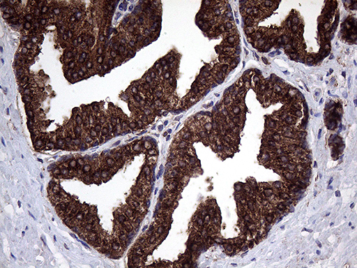 m05796 1 anti clathrin light chain clta mouse monoclonal antibody clone id oti2d12 ihc testing 4