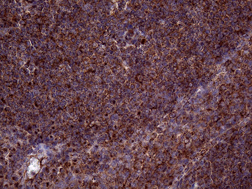 m05796 1 anti clathrin light chain clta mouse monoclonal antibody clone id oti2d12 ihc testing 5