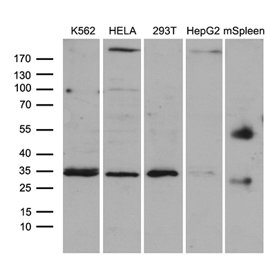 Western blot analysis of extracts (35ug) from 4 different cell lines and mouse spleen tissue lysate by using anti-CLTA monoclonal antibody (1:500)