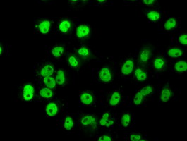 Anti-HNRNPF mouse monoclonal antibody (M05806) immunofluorescent staining of COS7 cells transiently transfected by pCMV6-ENTRY HNRNPF
