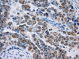 m05806 anti hnrnp f hnrnpf mouse monoclonal antibody clone id oti5f5 ihc testing 4