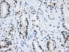 m05806 anti hnrnp f hnrnpf mouse monoclonal antibody clone id oti5f5 ihc testing 5