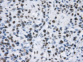 m05806 anti hnrnp f hnrnpf mouse monoclonal antibody clone id oti5f5 ihc testing 6
