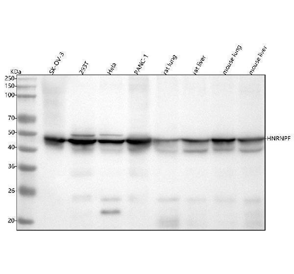  Western blot analysis of HNRNPF using anti-HNRNPF antibody (M05806)