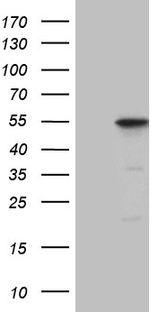 HEK293T cells were transfected with the pCMV6-ENTRY control (Left lane) or pCMV6-ENTRY DUSP5 (Right lane) cDNA for 48 hrs and lysed. Equivalent amounts of cell lysates (5 ug per lane) were separated by SDS-PAGE and immunoblotted with anti-DUSP5 (1:2000).