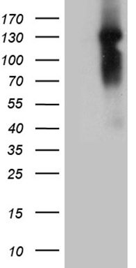 HEK293T cells were transfected with the pCMV6-ENTRY control (Left lane) or pCMV6-ENTRY NCOA7 (Right lane) cDNA for 48 hrs and lysed