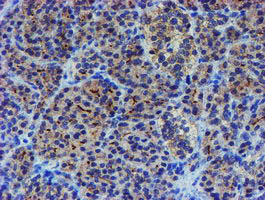 m05816 anti lim1 lhx1 mouse monoclonal antibody clone id oti2d5 ihc testing 2
