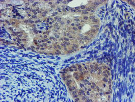 m05816 anti lim1 lhx1 mouse monoclonal antibody clone id oti2d5 ihc testing 3
