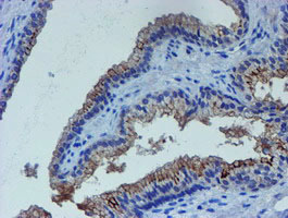 m05816 anti lim1 lhx1 mouse monoclonal antibody clone id oti2d5 ihc testing 4