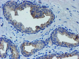 m05816 anti lim1 lhx1 mouse monoclonal antibody clone id oti2d5 ihc testing 5