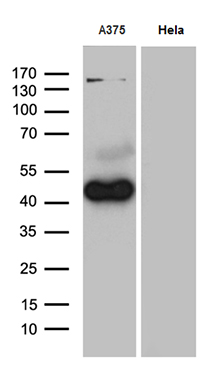 m05823 anti phlda1 mouse monoclonal antibody clone id oti4d9 wb testing 2