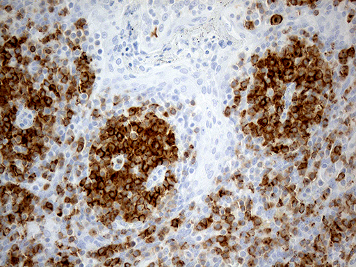 Immunohistochemical staining of paraffin-embedded Human tonsil within the normal limits using anti-LY9 mouse monoclonal antibody
