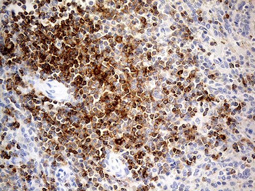 Immunohistochemical staining of paraffin-embedded Human spleen tissue within the normal limits using anti-LY9 mouse monoclonal antibody