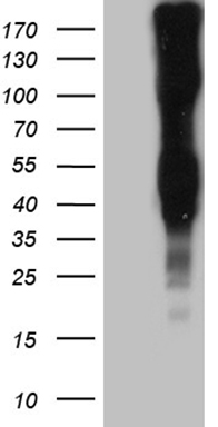 HEK293T cells were transfected with the pCMV6-ENTRY control (Left lane) or pCMV6-ENTRY LY9 (Right lane) cDNA for 48 hrs and lysed