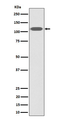 Western blot analysis of ZHX2 expression in HeLa cell lysate