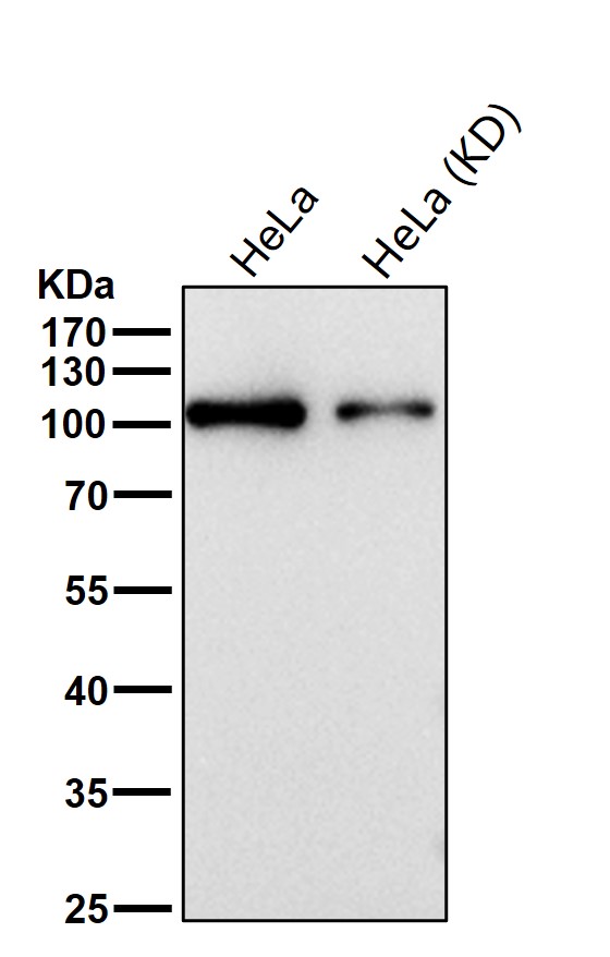 All lanes use the Antibody at 1:1K dilution for 1 hour at room temperature