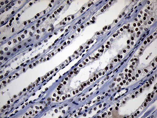 m05837 anti zhx2 mouse monoclonal antibody clone id oti2e11 ihc testing 10