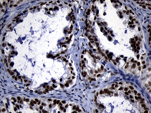 m05837 anti zhx2 mouse monoclonal antibody clone id oti2e11 ihc testing 4
