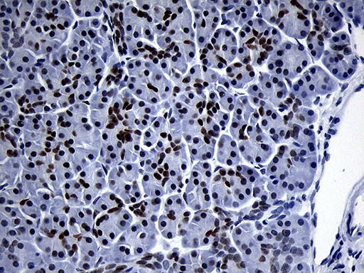 m05837 anti zhx2 mouse monoclonal antibody clone id oti2e11 ihc testing 5