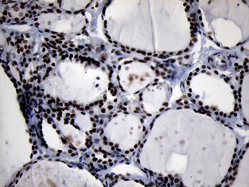 m05837 anti zhx2 mouse monoclonal antibody clone id oti2e11 ihc testing 6