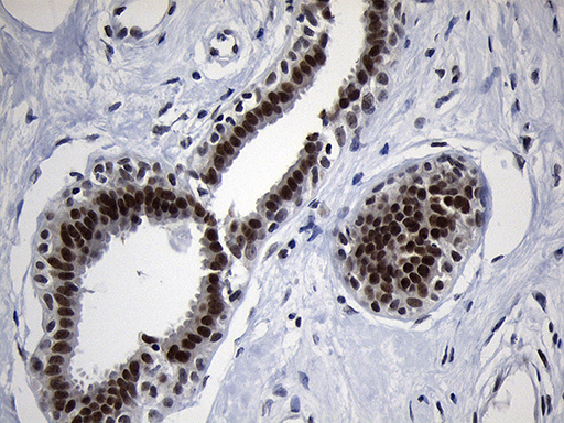 m05837 anti zhx2 mouse monoclonal antibody clone id oti2e11 ihc testing 7