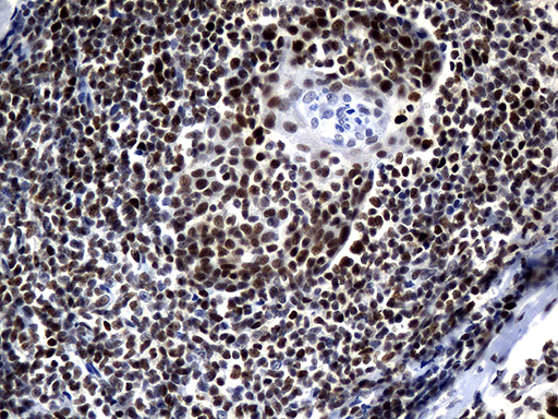 m05837 anti zhx2 mouse monoclonal antibody clone id oti2e11 ihc testing 8