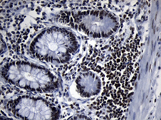 m05837 anti zhx2 mouse monoclonal antibody clone id oti2e11 ihc testing 9