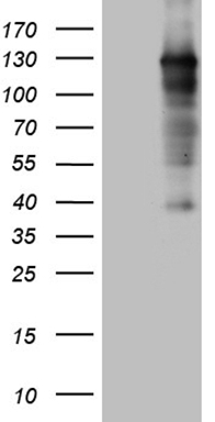 HEK293T cells were transfected with the pCMV6-ENTRY control (Left lane) or pCMV6-ENTRY ZHX2 (Right lane) cDNA for 48 hrs and lysed
