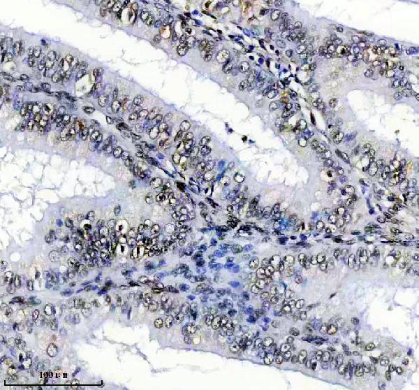 IHC analysis of SUOX using anti-SUOX antibody (M05838-1)