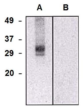Western blotting analysis of CLIC5a in HEK293-CLIC5a transfectants (A) and HEK293 cells (B) using mouse monoclonal antibody (clone CLIC5-02)