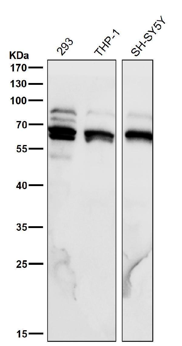 All lanes use the Antibody at 1:6K dilution for 1 hour at room temperature